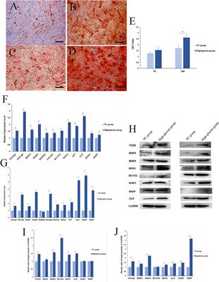 Effect of LncRNA-MALAT1 on mineralization of dental pulp cells in a high-glucose microenvironment